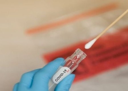 Secretaria de Saúde registra 34 mortes por covid em nova fase da doença em MS